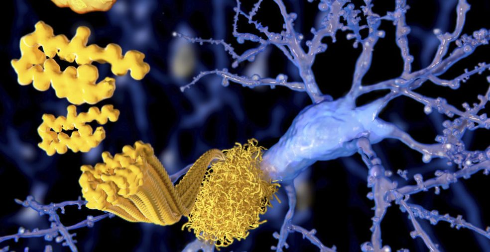 Amyloid beta peptide, illustration
